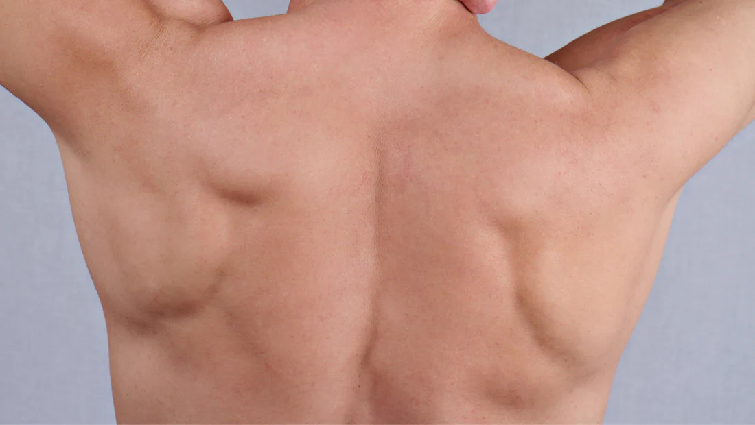 Common Misconceptions About Men's Laser Hair Removal Separating Science from Gym Talk