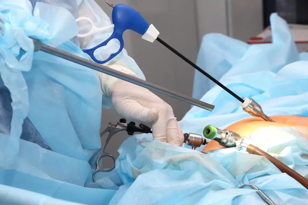 Why Minimally Invasive Surgery Is Becoming a Preferred Choice for Many Procedures